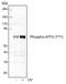 Activating Transcription Factor 2 antibody, MA5-27992, Invitrogen Antibodies, Western Blot image 