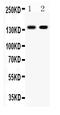 Cadherin 1 antibody, PB9561, Boster Biological Technology, Western Blot image 