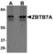 Zinc Finger And BTB Domain Containing 7A antibody, LS-B7026, Lifespan Biosciences, Western Blot image 