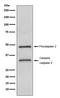 Caspase 2 antibody, M02384, Boster Biological Technology, Western Blot image 
