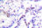 Cyclin E1 antibody, LS-C175985, Lifespan Biosciences, Immunohistochemistry paraffin image 