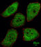 PTTG1 Regulator Of Sister Chromatid Separation, Securin antibody, 62-848, ProSci, Immunohistochemistry paraffin image 