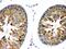 Transient Receptor Potential Cation Channel Subfamily M Member 5 antibody, PB9903, Boster Biological Technology, Immunohistochemistry paraffin image 