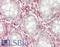 Ribosomal Protein S3 antibody, LS-B13732, Lifespan Biosciences, Immunohistochemistry paraffin image 