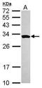 Survival Motor Neuron Domain Containing 1 antibody, PA5-31148, Invitrogen Antibodies, Western Blot image 