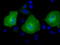 Adenylate Kinase 5 antibody, LS-C115581, Lifespan Biosciences, Immunofluorescence image 