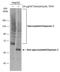 Glypican 3 antibody, GTX633303, GeneTex, Western Blot image 