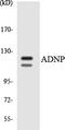 Activity Dependent Neuroprotector Homeobox antibody, LS-C200092, Lifespan Biosciences, Western Blot image 