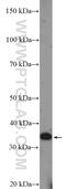 Defective In Cullin Neddylation 1 Domain Containing 3 antibody, 26356-1-AP, Proteintech Group, Western Blot image 