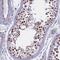 ALG10 Alpha-1,2-Glucosyltransferase antibody, NBP2-14281, Novus Biologicals, Immunohistochemistry frozen image 