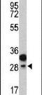 Protein C Receptor antibody, PA5-12519, Invitrogen Antibodies, Western Blot image 
