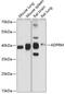 ADP-Ribose/CDP-Alcohol Diphosphatase, Manganese Dependent antibody, 14-682, ProSci, Western Blot image 