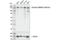 SWI/SNF Related, Matrix Associated, Actin Dependent Regulator Of Chromatin Subfamily C Member 1 antibody, 94962S, Cell Signaling Technology, Western Blot image 