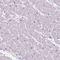 Immunoglobulin Like And Fibronectin Type III Domain Containing 1 antibody, HPA050415, Atlas Antibodies, Immunohistochemistry frozen image 