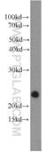 RAS Related 2 antibody, 12530-1-AP, Proteintech Group, Western Blot image 