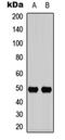 Interleukin 13 Receptor Subunit Alpha 1 antibody, LS-C359026, Lifespan Biosciences, Western Blot image 