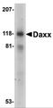 Death Domain Associated Protein antibody, 1163, ProSci, Western Blot image 