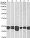 Parkinsonism Associated Deglycase antibody, 46-132, ProSci, Western Blot image 