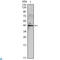 Inhibin Subunit Alpha antibody, LS-C812659, Lifespan Biosciences, Western Blot image 