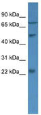 Guanylyl cyclase-activating protein 2 antibody, TA342731, Origene, Western Blot image 