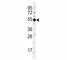 TRNA Aspartic Acid Methyltransferase 1 antibody, F40544-0.4ML, NSJ Bioreagents, Western Blot image 