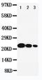 IL-6 antibody, PA1700, Boster Biological Technology, Western Blot image 