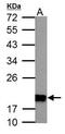 NADH:Ubiquinone Oxidoreductase Subunit S4 antibody, GTX105662, GeneTex, Western Blot image 
