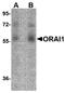 ORAI Calcium Release-Activated Calcium Modulator 1 antibody, orb75884, Biorbyt, Western Blot image 