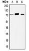 Histone Deacetylase 10 antibody, MBS822243, MyBioSource, Western Blot image 