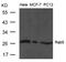 RAB5A, Member RAS Oncogene Family antibody, 79-729, ProSci, Western Blot image 