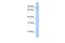 WD And Tetratricopeptide Repeats 1 antibody, GTX45327, GeneTex, Western Blot image 