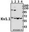 Potassium Voltage-Gated Channel Subfamily A Member 1 antibody, A01813, Boster Biological Technology, Western Blot image 