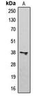 C-X-C Motif Chemokine Receptor 3 antibody, MBS820174, MyBioSource, Western Blot image 