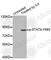 Signal Transducer And Activator Of Transcription 4 antibody, AP0137, ABclonal Technology, Western Blot image 