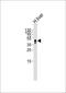 Haptoglobin antibody, MBS9213898, MyBioSource, Western Blot image 