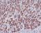 NFKB Inhibitor Alpha antibody, M01139, Boster Biological Technology, Immunohistochemistry paraffin image 