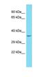 WW Domain Binding Protein 1 Like antibody, orb326719, Biorbyt, Western Blot image 