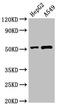 Pancreatic Lipase Related Protein 2 (Gene/Pseudogene) antibody, orb52867, Biorbyt, Western Blot image 