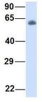 Serine Peptidase Inhibitor, Kunitz Type 1 antibody, GTX46629, GeneTex, Western Blot image 