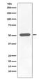 Checkpoint Kinase 1 antibody, P01060, Boster Biological Technology, Western Blot image 