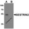 Sestrin 2 antibody, 8023, ProSci, Western Blot image 