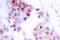 Myocyte Enhancer Factor 2A antibody, LS-C176116, Lifespan Biosciences, Immunohistochemistry frozen image 