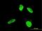 Testis Associated Actin Remodelling Kinase 2 antibody, MA5-21035, Invitrogen Antibodies, Immunofluorescence image 