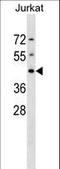 Deoxyhypusine Synthase antibody, LS-C167392, Lifespan Biosciences, Western Blot image 