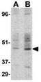 CD209 Molecule antibody, GTX31656, GeneTex, Western Blot image 