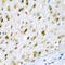 Tryptophan Hydroxylase 2 antibody, LS-C346253, Lifespan Biosciences, Immunohistochemistry frozen image 