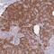 Trafficking Protein Particle Complex 5 antibody, HPA049064, Atlas Antibodies, Immunohistochemistry paraffin image 