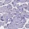 Solute Carrier Family 13 Member 5 antibody, HPA044343, Atlas Antibodies, Immunohistochemistry paraffin image 
