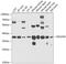 NADH dehydrogenase [ubiquinone] 1 alpha subcomplex subunit 9, mitochondrial antibody, GTX65579, GeneTex, Western Blot image 