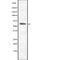 Interleukin 20 Receptor Subunit Alpha antibody, abx216204, Abbexa, Western Blot image 